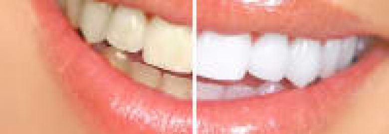 Jill Cooper – Dental Care With Jill Cooper